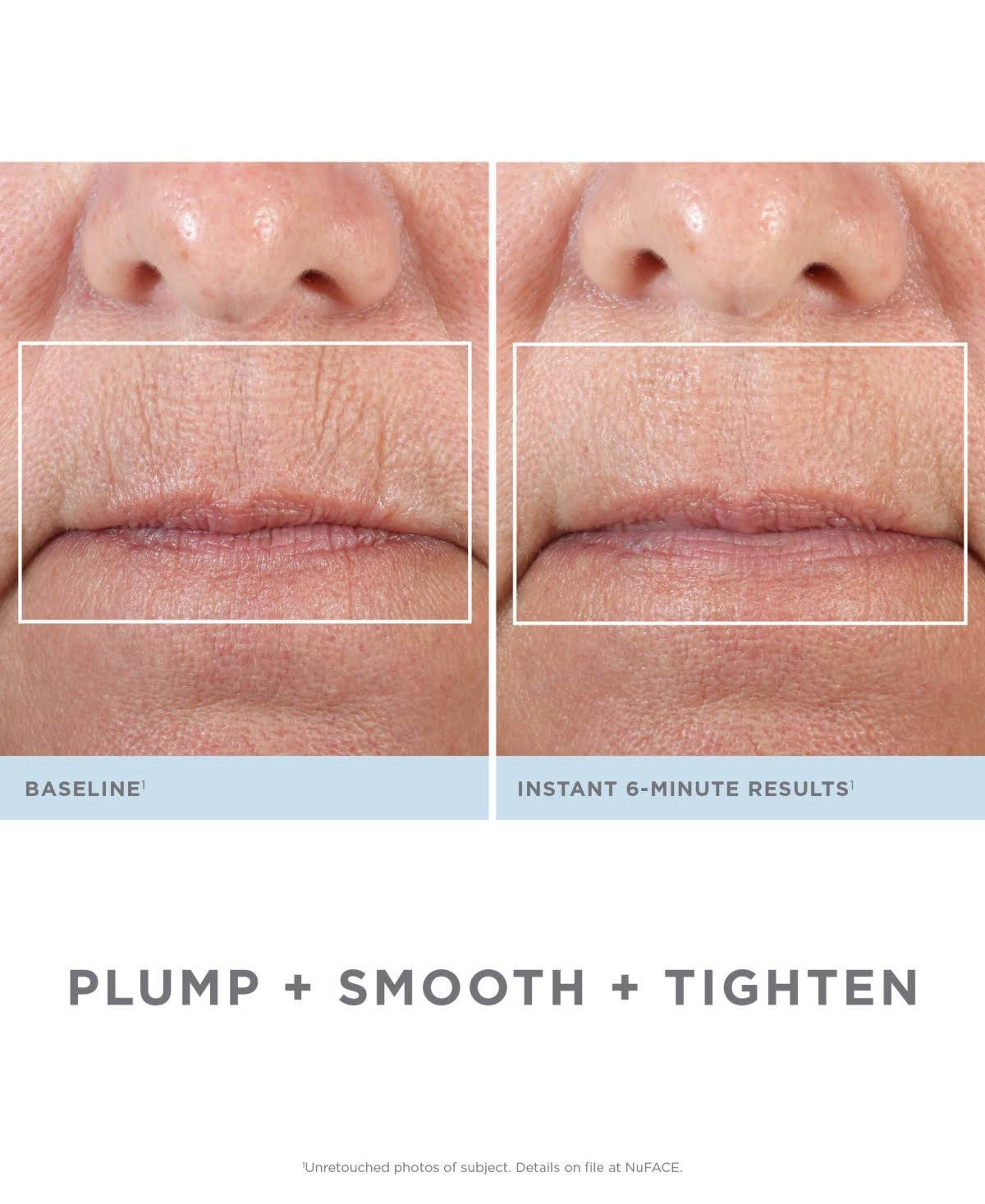 Facial Kit L507360