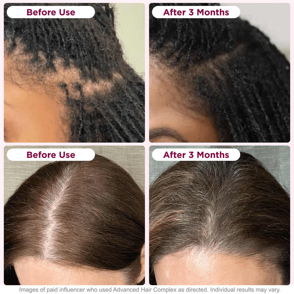 Biotin Hair Growth Supplement 30 Capsules A81333