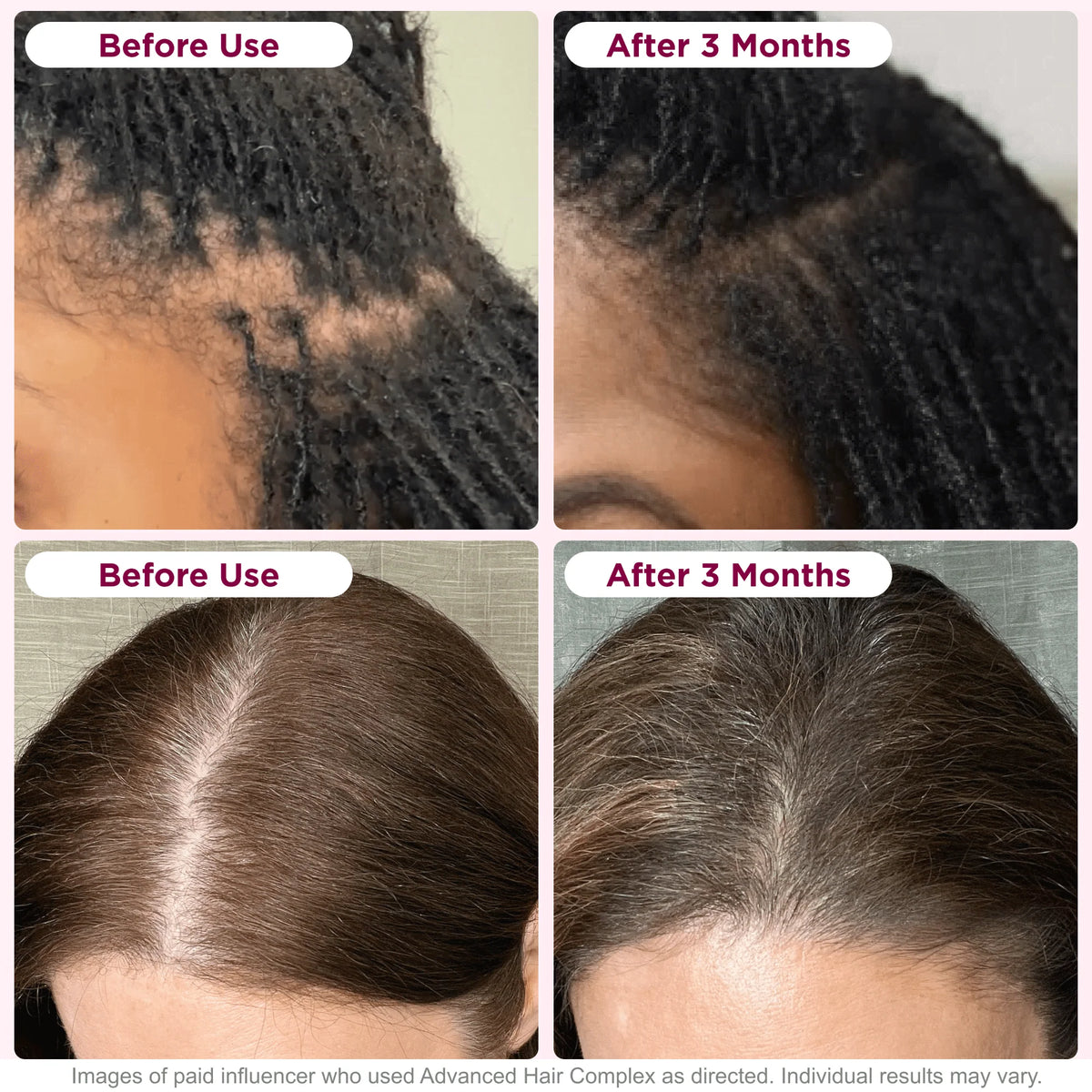 Biotin Hair Growth Supplement 30 Capsules A81333