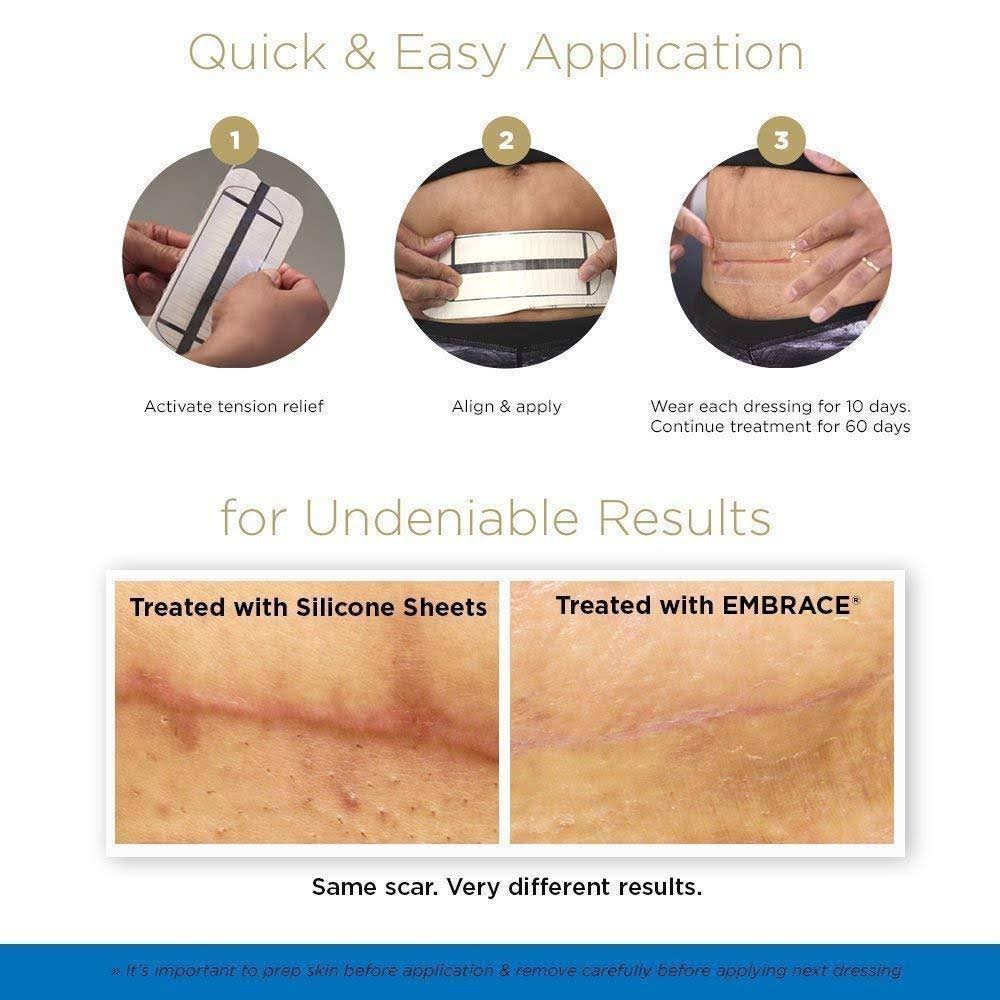 Silicone Sheets for New Scars D568103