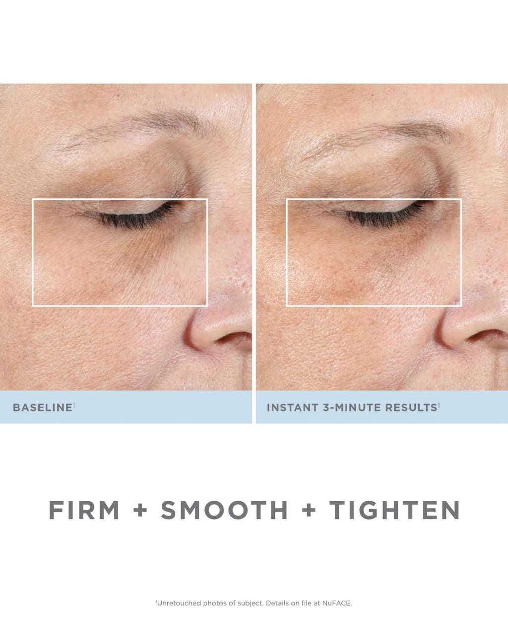 Facial Kit L507360