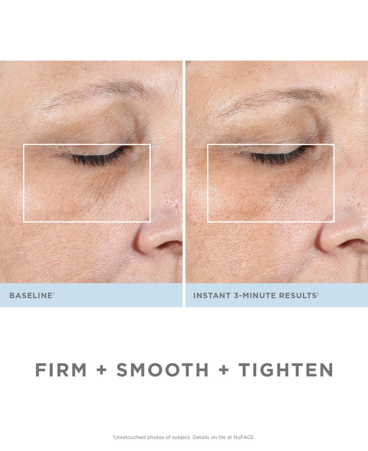 Facial Kit L507360