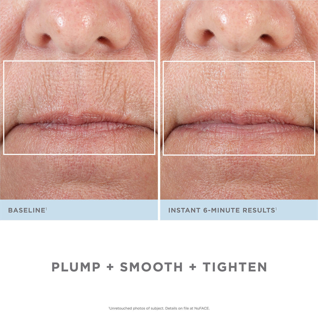 Facial Kit L507360