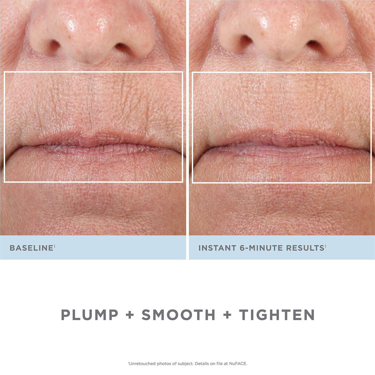 Facial Kit L507360